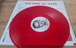 VICTIMS OF HATE / SCALP

 - 2