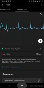 Francouzské chytré hodinky -  měří EKG - nové - 50% sleva - 5