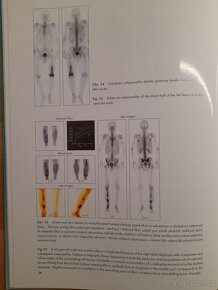 Atlas kostní scintigrafie - 6